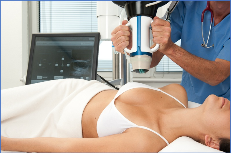 Echotherapie bei einem gutartigen Brustknoten